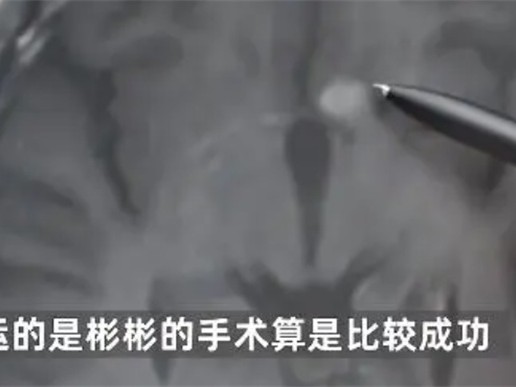 男孩一天喝9升水被查出肿瘤 多喝水都危害